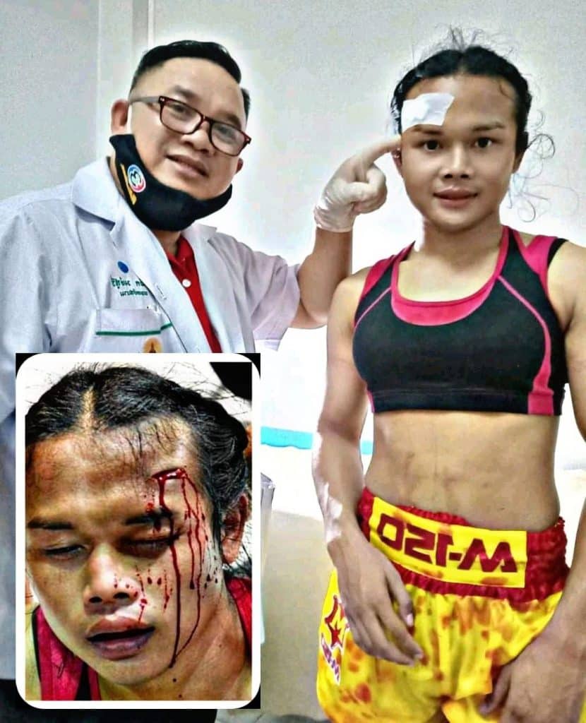 ข่าวมวยไทย