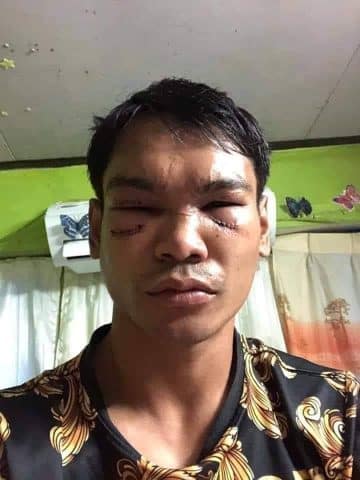 ข่าวมวยไทย